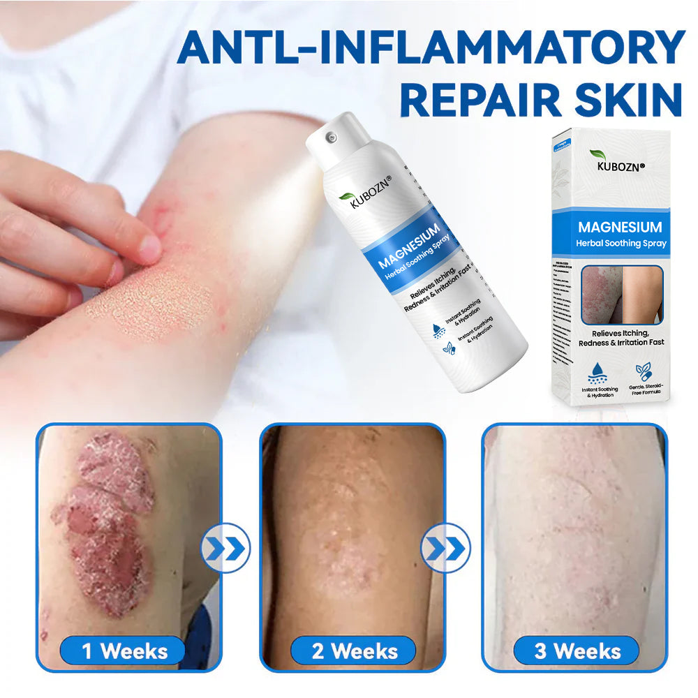 ⚕️ KUBOZN® Magnesium Herbal Psoriasis Spray ⚡3-MINUTE RELIEF