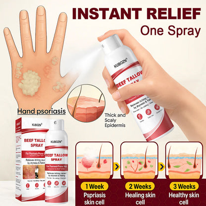 KUBOZN® Beef Tallow Spray — The No-Rub Relief for Psoriasis-Prone Skin✨
