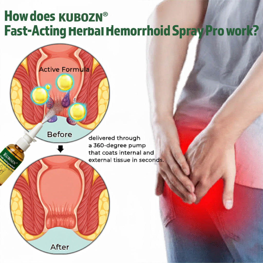 KUBOZN® Fast-Acting Herbal Hemorrhoid Spray Pro🩸(Stops Bleeding Instantly & Targets Internal/External Piles)