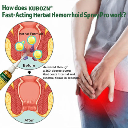 KUBOZN® Fast-Acting Herbal Hemorrhoid Spray Pro🩸(Stops Bleeding Instantly & Targets Internal/External Piles)